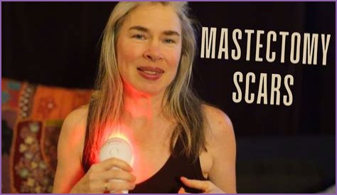 Health Minister says it's 'deeply worrying' not everyone has access to secondary mastectomy