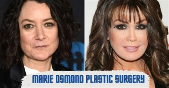 Marie Osmond Plastic Surgery: Adopting Artificial Enhancers or Glowing Naturally!